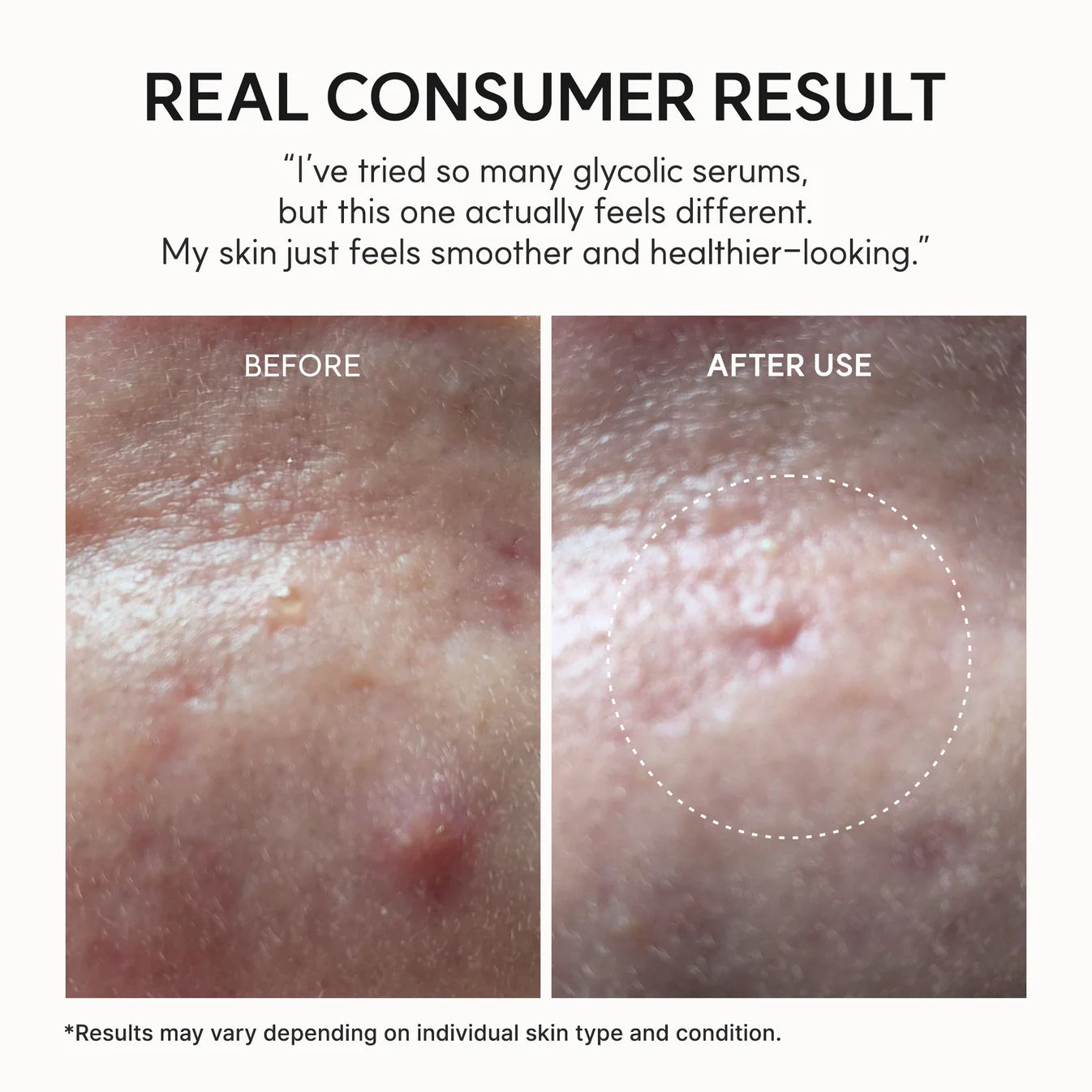 Arencia Eraser Shot Glycolic Acid Booster daily clarifying multi acid formula smoother skin