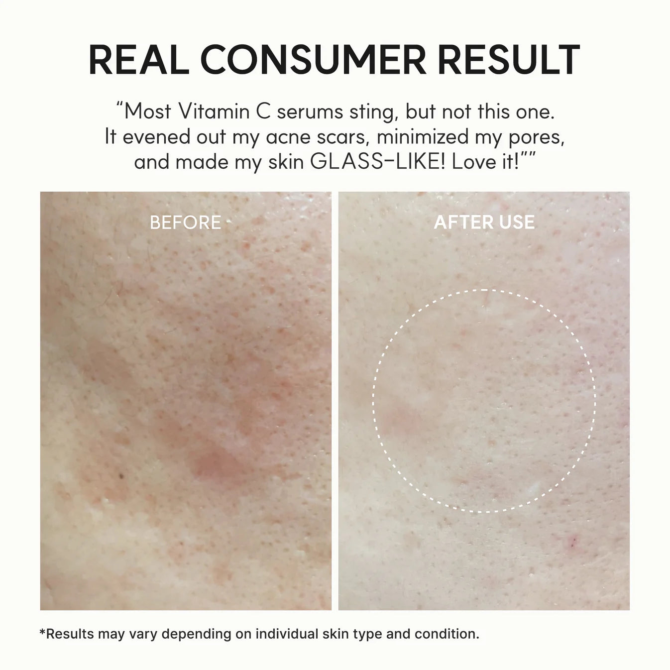 Arencia Vitamin C Booster Shot Pure Vitamin C Glutathione brightening serum healthy glow
