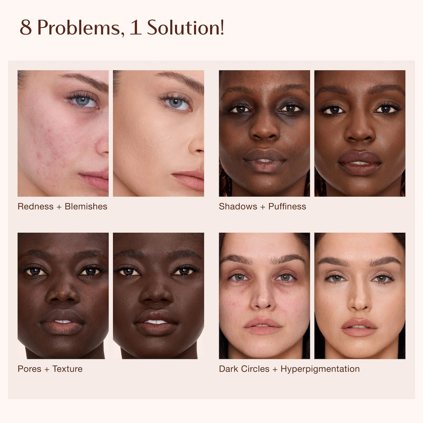 Charlotte Tilbury Airbrush Flawless Crease-Proof Long-Wear Blur Concealer with Hyaluronic Acid – Color: 4 Fair-Medium